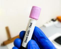 sangue campione tubo contenere con stelo cellula, ematologia. foto