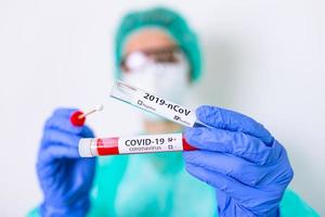 covid-19 nasale tampone laboratorio test nel ospedale laboratorio, infermiera Tenere test tubo con sangue per 2019-ncov analizzando. romanzo Cinese coronavirus sangue test concetto. foto