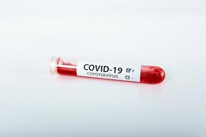 test tubo con sangue campione per covid-19 test, romanzo coronavirus 2019 trovato nel Wuhan, Cina foto