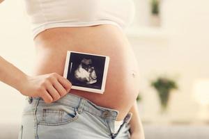 stretta di donna incinta con ecografia sulla sua pancia foto