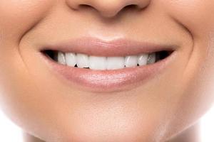 avvicinamento di bellissimo femmina Sorridi con bianca denti foto