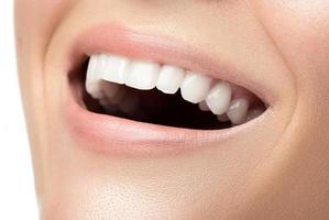 femmina bocca con un' bellissimo bianca denti foto