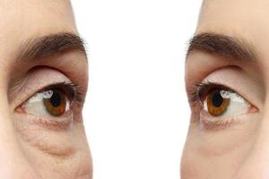 anti invecchiamento trattamento. femmina occhi dopo ringiovanimento. foto