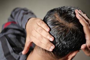 concetto di perdita di capelli con l'uomo che controlla i suoi capelli foto