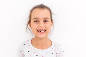 poco ragazza primo dente mancante su un' bianca sfondo foto