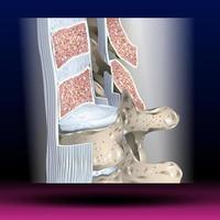 anteriore longitudinale legamento - corpo parti - colonna vertebrale foto