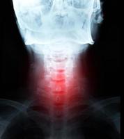 dettaglio della pellicola dell'immagine a raggi X del collo e del dolore nella zona rossa foto