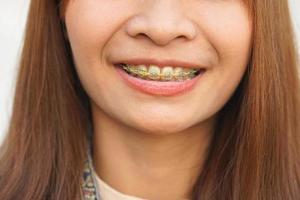 asiatico donna sorridente con bretelle foto