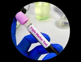 sangue campione per triplicare marcatore test. foto