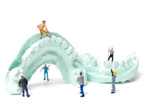 lavoratori in miniatura che riempiono i denti finti e li inseriscono in una protesi realizzata con gesso, concetto di laboratorio di protesi dentale foto