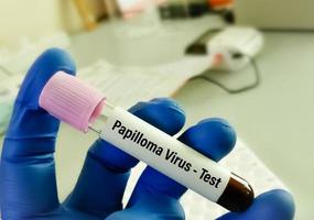 HPV virus o umano papillomavirus su tubo , medico e Salute cura concetto. foto