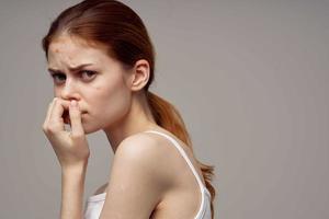 bellissimo donna nel un' bianca maglietta brufoli su il viso avvicinamento foto