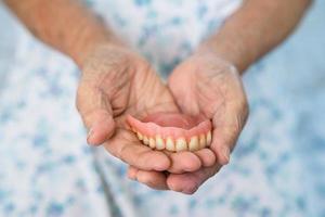 asiatico anziano donna paziente Tenere per uso dentiera, salutare forte medico concetto. foto