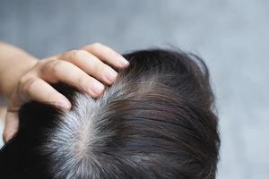 indietro Visualizza di giovane persone precoce grigio capelli, mostrando nero canuto capelli radici su testa modificare per anziano vecchio uomo all'aperto. foto