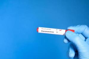 provetta rossa del coronavirus foto