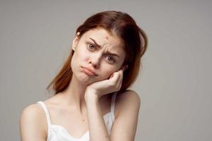 dai capelli rossi donna facciale pelle i problemi dermatologia leggero sfondo foto