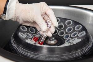 scienziato collocazione alcuni test tubi in il centrifuga. scienziato preparazione osso midollo campioni per flusso citometrico analisi nel il laboratorio. foto