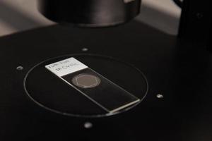 avvicinamento di un' diapositiva stato osservato con un rovesciato microscopio. fluorescenza nel situ ibridazione tecnica. foto