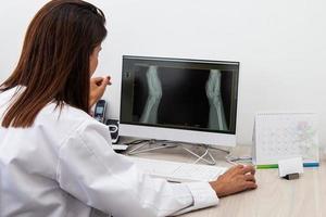 traumatologo femmina medico rivedere un raggi X di un' del paziente mani. scheletro osso malattia esame e medico aiuto. carriera concetto. foto