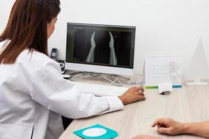 traumatologo femmina medico rivedere un raggi X di un' del paziente mani. scheletro osso malattia esame e medico aiuto. carriera concetto. foto