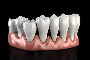 dentale corona posizionamento 3d illustrazione. ai generato foto