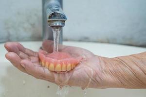 paziente asiatico anziano o anziano anziano con protesi parziale dei denti sostitutivi foto