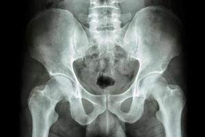 film x ray bacino umano e articolazioni dell'anca foto