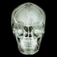 film x ray persone asiatiche s cranio persone tailandesi
