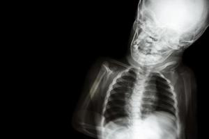 corpo a raggi x del bambino e area vuota sul lato sinistro foto