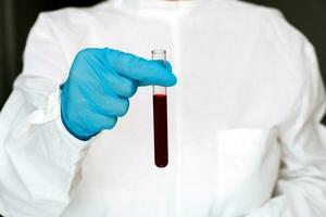 medico Tenere un' test tubo con sangue foto