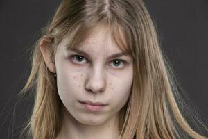 il viso di un' adolescenziale ragazza con brufoli avvicinamento su un' grigio sfondo. foto