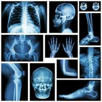 set di raggi x più parte dell'essere umano. sistema scheletrico . foto