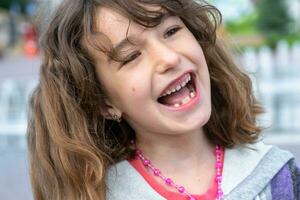 sdentato contento Sorridi di un' ragazza con un' caduto inferiore latte dente avvicinamento. mutevole denti per molari nel infanzia foto