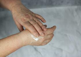 un vecchio, anziano donna sbavature sua mani con crema. sfondo e struttura foto