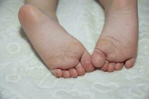figli di dermatite su il pelle di il gambe, asciutto pelle di un' bambino, medico assistenza. alto qualità foto. foto