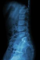 colonna lombare della radiografia del bambino foto