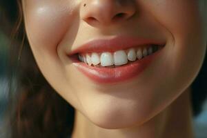 giovane donna con bellissimo salutare Sorridi, avvicinamento. dentale cura. ai generato professionista foto