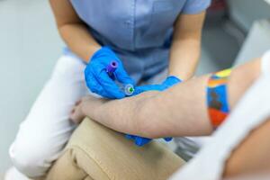 vicino su mano di infermiera, medico o medico tecnologo nel blu guanti assunzione sangue campione a partire dal un' paziente nel il Ospedale. foto