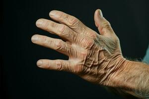 vecchio uomo grappi con persistente mano dolore, un' cartello di invecchiamento ai generato foto