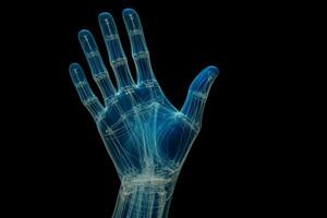umano mano comune e osso struttura X raggio Immagine isolato su un' pendenza sfondo foto