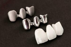 denti impiantare e corona installazione processi parti isolato su un' nero sfondo. medico preciso 3d modello. foto