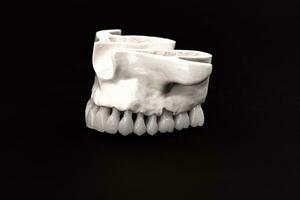 inferiore umano mascella con denti anatomia modello isolato su nero sfondo. salutare denti, dentale cura e ortodontico medico concetto. foto