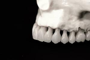inferiore umano mascella con denti anatomia modello isolato su nero sfondo. salutare denti, dentale cura e ortodontico medico concetto. foto