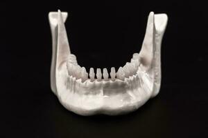 inferiore umano mascella con denti anatomia modello isolato su nero sfondo. salutare denti, dentale cura e ortodontico medico assistenza sanitaria concetto. foto