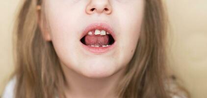 ritratto di un' poco bambino ragazza in movimento sua latte davanti dente con sua lingua nel Aperto bocca. foto