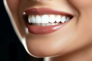 Perfetto salutare denti Sorridi di un' giovane donna a un' dentista. denti sbiancamento. dentale cura, stomatologia concetto di ai generato foto