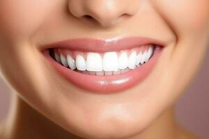 Perfetto salutare denti Sorridi di un' giovane donna a un' dentista. denti sbiancamento. dentale cura, stomatologia concetto di ai generato foto