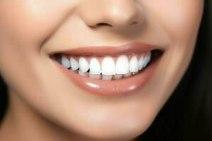 Perfetto salutare denti Sorridi di un' giovane donna a un' dentista. denti sbiancamento. dentale cura, stomatologia concetto di ai generato foto