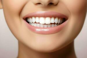 Perfetto salutare denti Sorridi di un' giovane donna a un' dentista. denti sbiancamento. dentale cura, stomatologia concetto di ai generato foto