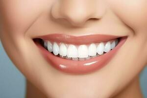 Perfetto salutare denti Sorridi di un' giovane donna a un' dentista. denti sbiancamento. dentale cura, stomatologia concetto di ai generato foto